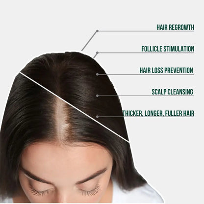 HAIR RESTORATION SYSTEM (90 DAY)